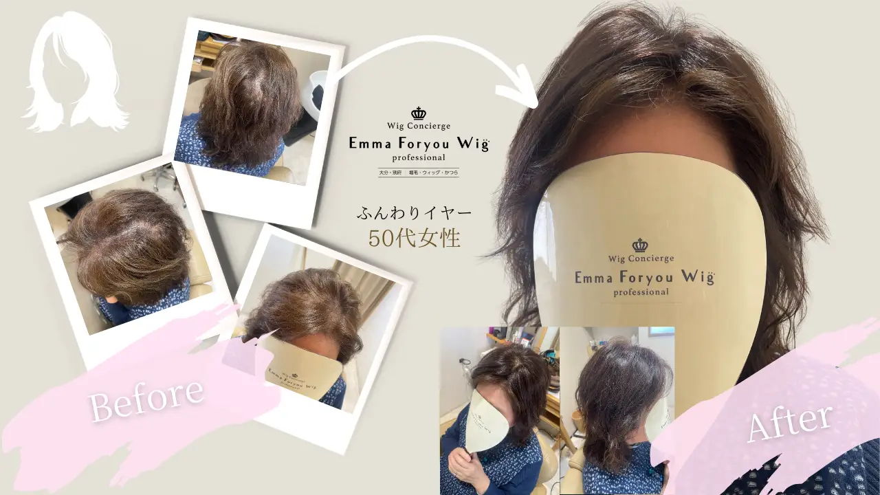 【SEAL限定商品】 女性用ウィッグ - 大分の増毛・育毛・かつら・ウィッグ専門の ウィッグ・エクステ